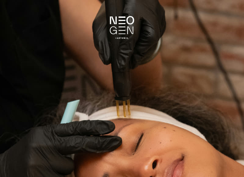 Neogen plasma treatment being applied to face